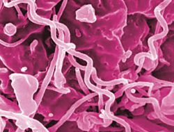 Antibiotic Shortage Could Fuel Rise in Syphilis Rates